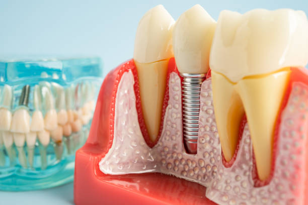 Best Dental Exams and Cleanings  in Newcastle, WY